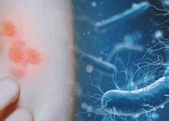 Pandemi Mereda, Penyakit Baru Bermunculan