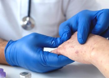 WHO Tetapkan Wabah Cacar Monyet Darurat Global