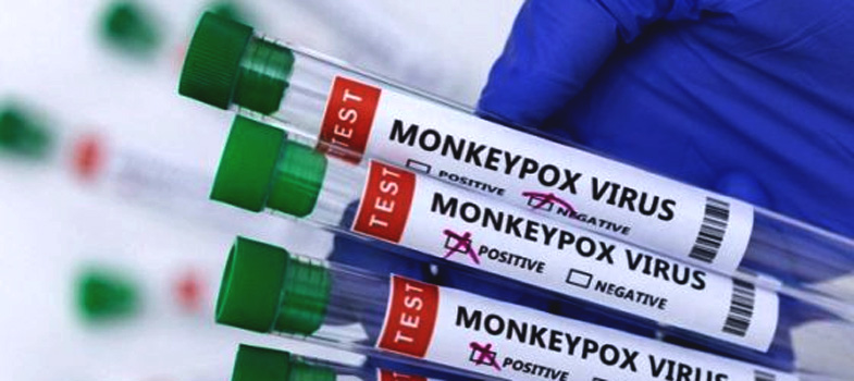 Wabah virus cacar monyet terdeteksi dari air liur menurut sebuah studi.(pixabay)