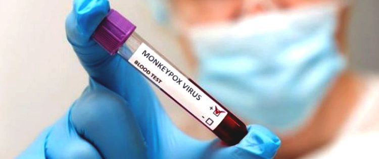 Kementerian Kesehatan Jepang setuju vaksin cacar KM Biologics Co untuk mencegah cacar monyet. (net)